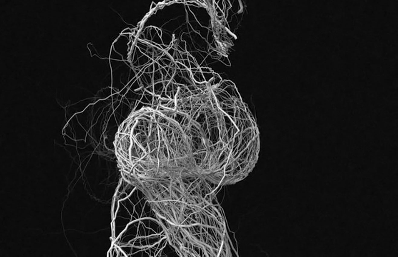 Eva-di-pierro-videos-what-is-fascia eva-di-pierro-videos-what-is-fascia